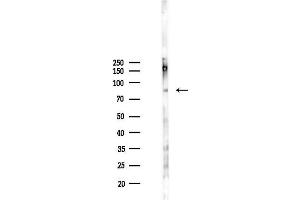 Western blot analysis of lysates from 293 cells(LPS 4h treatment), using Phospho-Cortactin (Tyr466) Antibody at 1/1000 dilution.