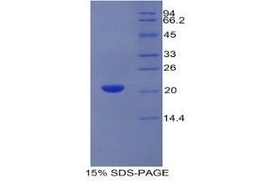 SDS-PAGE (SDS) image for Growth Arrest-Specific 6 (GAS6) (AA 356-511) protein (His tag) (ABIN1980689)