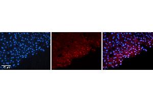 Rabbit Anti-FOSB Antibody   Formalin Fixed Paraffin Embedded Tissue: Human Liver Tissue Observed Staining: Nucleus in hepatocytes Primary Antibody Concentration: 1:100 Other Working Concentrations: N/A Secondary Antibody: Donkey anti-Rabbit-Cy3 Secondary Antibody Concentration: 1:200 Magnification: 20X Exposure Time: 0.