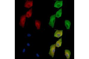 ABIN7096946 and ABIN7101012 staining  cells by IF/ICC. (SLC25A42 anticorps)