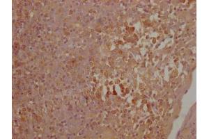 IHC image of ABIN7149430 diluted at 1:500 and staining in paraffin-embedded human lymph node tissue performed on a Leica BondTM system.