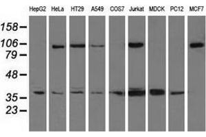 Western blot analysis of extracts (35 µg) from 9 different cell lines by using anti-XRCC1 monoclonal antibody. (XRCC1 anticorps)