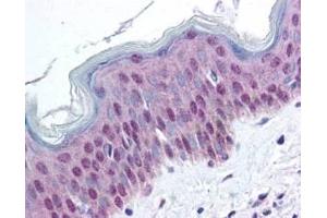 affinity purified anti-HMGN pS20/pS24 antibody was used at 20 ug/ml to detect signal in a variety of tissues including multi-human, multi-brain and multi-cancer slides.
