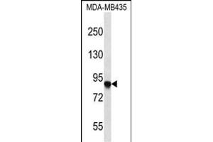 AF Antibody (C-term) 2749b western blot analysis in MDA-M cell line lysates (35 μg/lane). (AFAP anticorps  (C-Term))