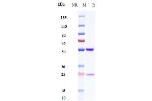 Anti-ICOS / CD278 Reference Antibody (MEDI-570) on SDS-PAGE under reducing (R) condition.