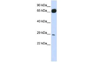 PRTFDC1 antibody used at 1 ug/ml to detect target protein. (PRTFDC1 anticorps  (N-Term))