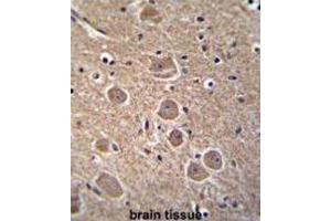 Immunohistochemistry (IHC) image for anti-Tumor Protein P53 Inducible Nuclear Protein 1 (TP53INP1) antibody (ABIN2996348) (TP53INP1 anticorps)