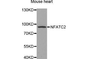 Western blot analysis of extracts of mouse heart, using NFATC2 antibody (ABIN5971589) at 1/500 dilution. (NFAT1 anticorps)