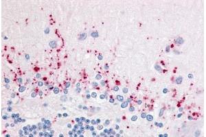 Human Brain, Cerebellum (formalin-fixed, paraffin-embedded) stained with WNT2B antibody ABIN213587 at 5 ug/ml followed by biotinylated goat anti-rabbit IgG secondary antibody ABIN481713, alkaline phosphatase-streptavidin and chromogen. (WNT2B anticorps  (Internal Region))