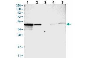 Western blot analysis of Lane 1: RT-4, Lane 2: U-251 MG, Lane 3: Human Plasma, Lane 4: Liver, Lane 5: Tonsil with NDRG3 polyclonal antibody . (NDRG3 anticorps)