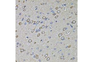 Immunohistochemistry of paraffin-embedded rat brain using PTCD3 antibody. (PTCD3 anticorps  (AA 450-689))