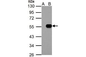 WB Image IP6K1 antibody detects IP6K1 protein by western blot analysis. (IP6K1 anticorps)