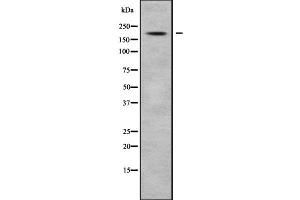 Western blot analysis of ABCC8 using COS7 whole cell lysates (ABCC8 anticorps)