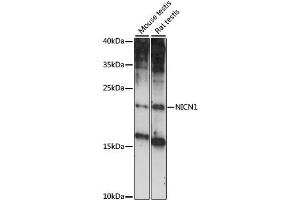 Western blot analysis of extracts of various cell lines, using NICN1 antibody (ABIN6293891) at 1:1000 dilution. (NICN1 anticorps)