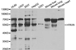 Western Blotting (WB) image for anti-Serotonin Receptor 2B (HTR2B) antibody (ABIN1876871) (Serotonin Receptor 2B anticorps)