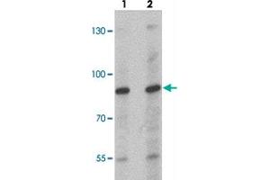 Western blot analysis of NCBP1 in HeLa cell lysate with NCBP1 polyclonal antibody  at (lane 1) 1 and (lane 2) 2 ug/mL. (NCBP1 anticorps  (Internal Region))