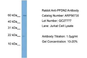 Western Blotting (WB) image for anti-Prefoldin Subunit 2 (PFDN2) (Middle Region) antibody (ABIN2786872) (PFDN2 anticorps  (Middle Region))