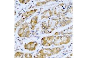 Immunohistochemical analysis of SETD5 staining in human stomach formalin fixed paraffin embedded tissue section.