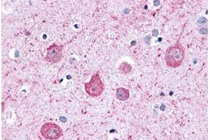 Immunohistochemical staining of human brain, neurons and glia with LPHN2 polyclonal antibody . (LPHN2 anticorps  (C-Term))