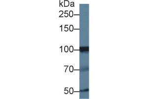 Western blot analysis of Human Jurkat cell lysate, using Human INPP4A Antibody (1 µg/ml) and HRP-conjugated Goat Anti-Rabbit antibody ( (INPP4A anticorps  (AA 1-137))