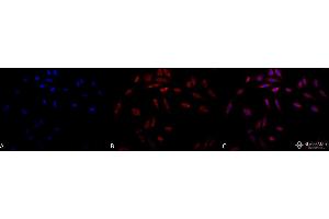Immunocytochemistry/Immunofluorescence analysis using Mouse Anti-Hsp47 Monoclonal Antibody, Clone 1C4-1A6 . (SERPINH1 anticorps  (Atto 390))