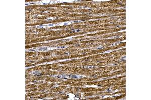 Immunohistochemistry of paraffin-embedded rat heart using PDE3A Rabbit pAb (ABIN7269301) at dilution of 1:250 (40x lens).