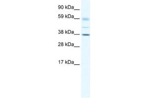 Western Blotting (WB) image for anti-SRY (Sex Determining Region Y)-Box 17 (SOX17) antibody (ABIN2460679)