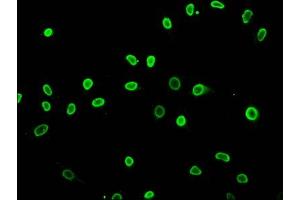 anti-Histone Cluster 1, H3a (HIST1H3A) (acLys27) antibody