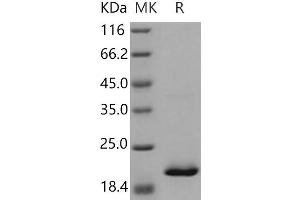 Western Blotting (WB) image for Retinol Binding Protein 4, Plasma (RBP4) (Active) protein (His tag) (ABIN7320388)