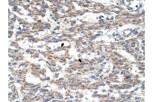 DUT antibody was used for immunohistochemistry at a concentration of 4-8 ug/ml to stain Myocardial cells (arrows) in Human Heart.