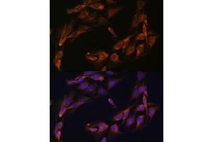 Immunofluorescence analysis of C6 cells using Osteocalcin antibody (ABIN6134565, ABIN6137546, ABIN6137547 and ABIN6221793) at dilution of 1:100.