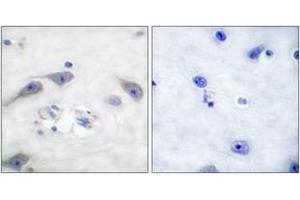 Immunohistochemistry analysis of paraffin-embedded human brain tissue, using DARPP-32 (Ab-75) Antibody. (DARPP32 anticorps  (AA 41-90))