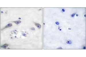 Immunohistochemistry analysis of paraffin-embedded human brain tissue, using DARPP-32 (Ab-75) Antibody. (DARPP32 anticorps  (AA 41-90))