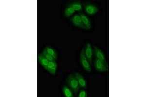 Immunofluorescent analysis of HepG2 cells using ABIN7161932 at dilution of 1:100 and Alexa Fluor 488-congugated AffiniPure Goat Anti-Rabbit IgG(H+L) (NXF1 anticorps  (AA 1-130))