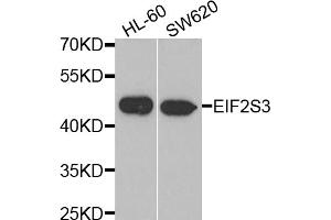 Western blot analysis of extracts of various cell lines, using EIF2S3 antibody (ABIN5975415) at 1/1000 dilution. (EIF2S3 anticorps)