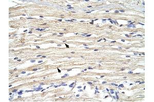FBXL11 antibody was used for immunohistochemistry at a concentration of 4-8 ug/ml to stain Skeletal muscle cells (arrows) in Human Muscle. (KDM2A anticorps  (N-Term))