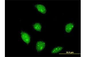 Immunofluorescence of monoclonal antibody to FLI1 on HeLa cell. (FLI1 anticorps  (AA 1-452))