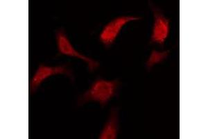 ABIN6275984 staining Hela by IF/ICC. (LPAR3 anticorps  (Internal Region))