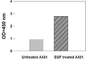 Image no. 3 for Signal Transducer and Activator of Transcription 3 (Acute-Phase Response Factor) (STAT3) ELISA Kit (ABIN1981729)
