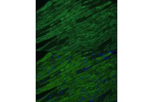 Immunofluorescence analysis of mouse heart cells using TNNI3 antibody (ABIN6132729, ABIN6149357, ABIN6149359 and ABIN6213640) at dilution of 1:100. (TNNI3 anticorps  (AA 1-210))