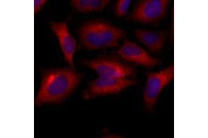 Immunofluorescenitrocellulosee of human HeLa cells stained with Hoechst 3342 (Blue) for nucleus staining and monoclonal anti-human BAK1 antibody (1:500) with Texas Red (Red). (BAK1 anticorps  (AA 29-187))