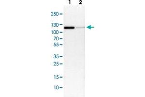 Western Blot (Cell lysate) analysis with CTNND1 polyclonal antibody  Lane 1: NIH-3T3 cell lysate (Mouse embryonic fibroblast cells) Lane 2: NBT-II cell lysate (Rat Wistar bladder tumour cells) (CTNND1 anticorps)