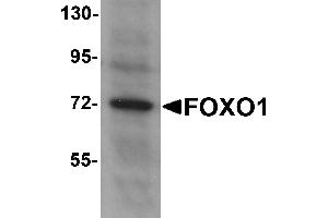 Western Blotting (WB) image for anti-Forkhead Box O1 (FOXO1) (N-Term) antibody (ABIN1031383) (FOXO1 anticorps  (N-Term))