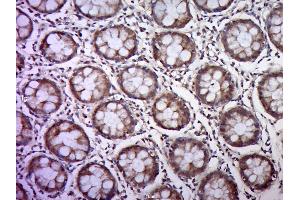 Paraformaldehyde-fixed, paraffin embedded human colon, Antigen retrieval by boiling in sodium citrate buffer (pH6.