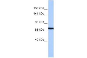 PCDH15 antibody used at 1 ug/ml to detect target protein. (PCDH15 anticorps  (N-Term))