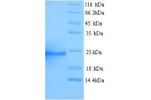 SDS-PAGE (SDS) image for Aquaporin 4 (AQP4) (AA 253-323) protein (His tag) (ABIN5713252)