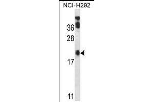 Western blot analysis in NCI-H292 cell line lysates (35ug/lane). (PERP anticorps  (C-Term))