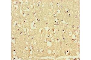 Immunohistochemistry of paraffin-embedded human brain tissue using ABIN7172553 at dilution of 1:100