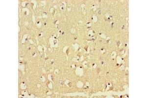 Immunohistochemistry of paraffin-embedded human brain tissue using ABIN7172553 at dilution of 1:100 (GATA6 anticorps  (AA 496-595))