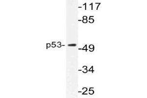 Western blot (WB) analysis of p53 antibody in extracts from K562 cells. (p53 anticorps)